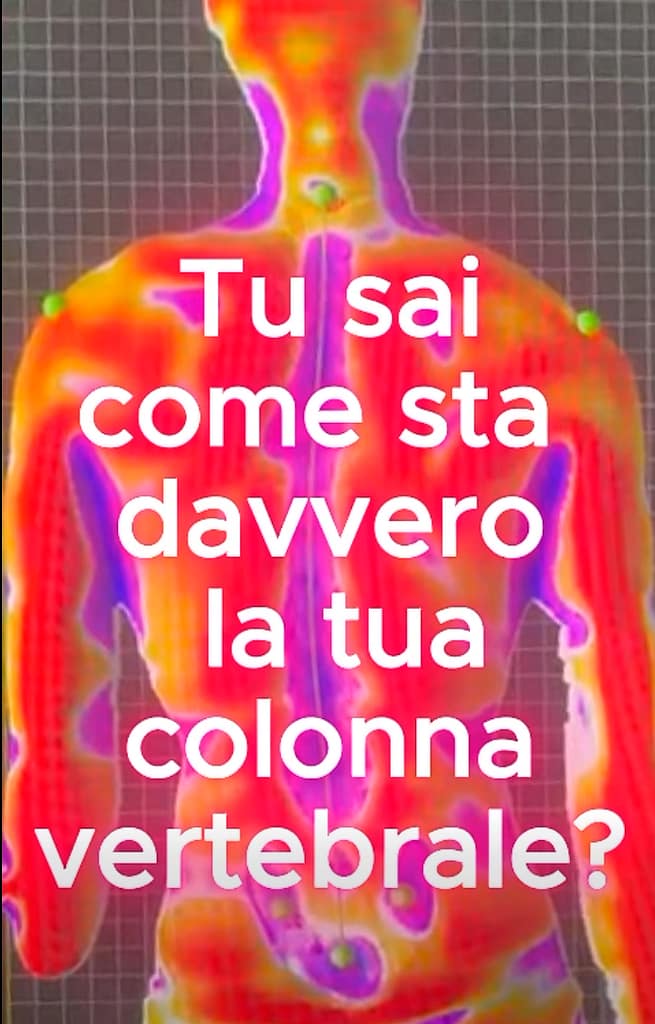 Home valutazione posturale spine 3d